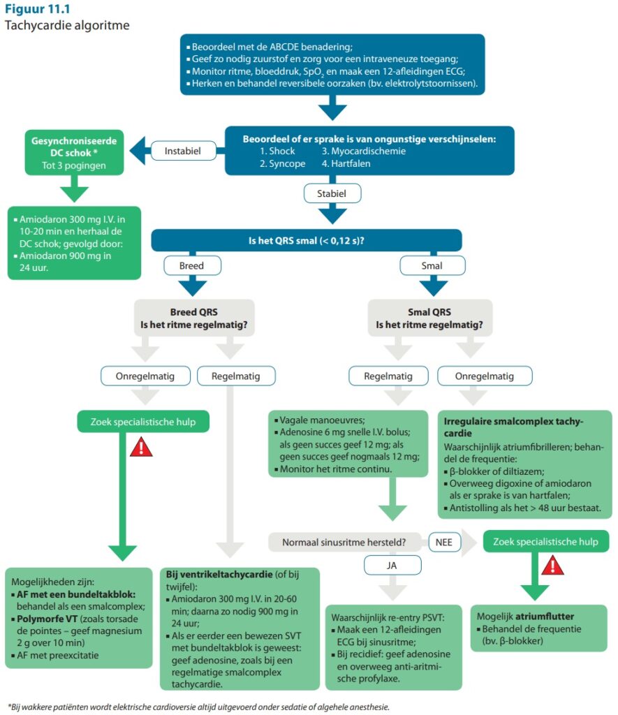 Tachycardie algoritme